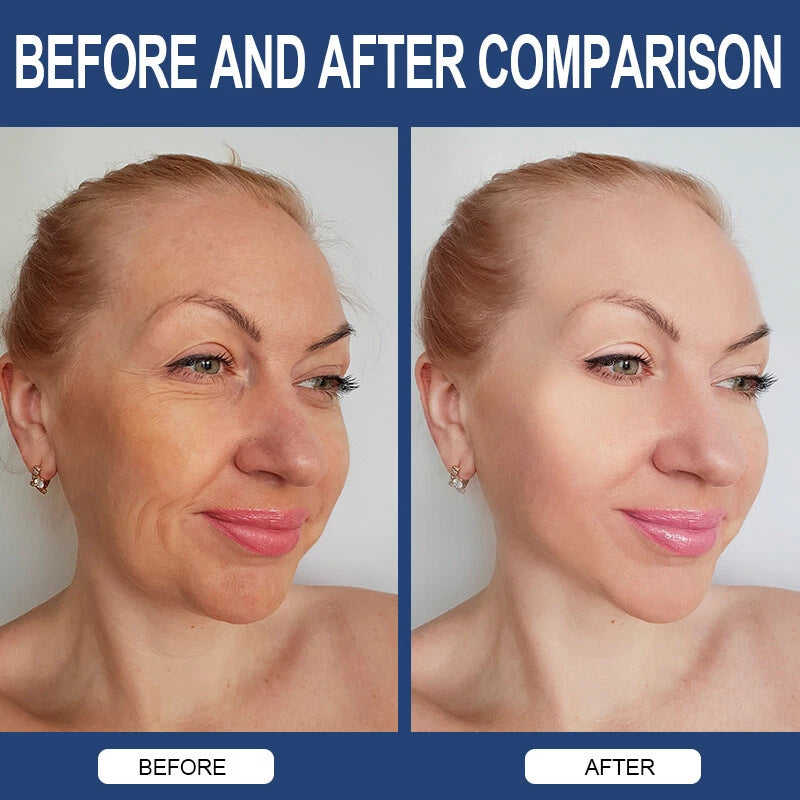 Hyaluronic Acid Anti-Aging Hydrating Capsules – Skin Hydration, Wrinkle Support & Joint Health